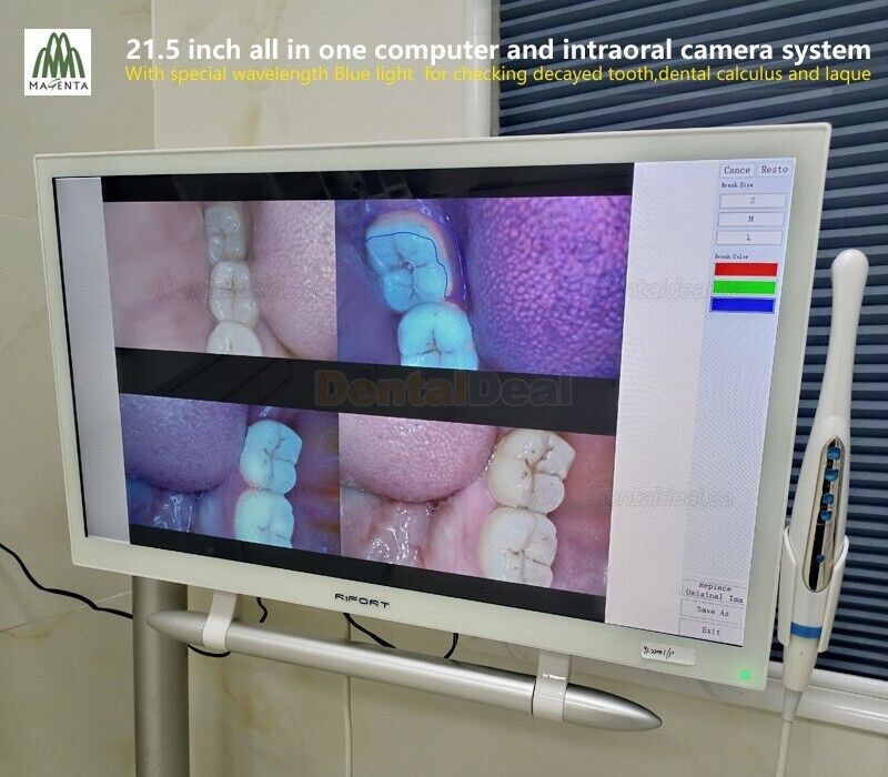 Magenta YF-2200P+ 21.5 Inch Touch Screen Intraoral Camera VGA+HDMI
